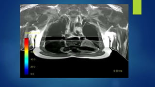 4D FLOW MRI | PPTX