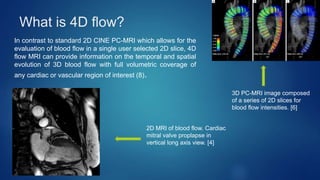 4D FLOW MRI | PPTX