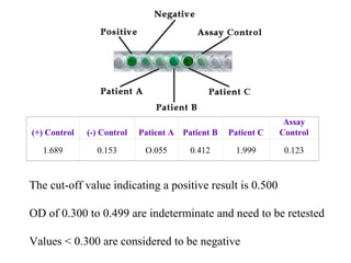 The cut-off value indicating a positive result is 0.500  O D  of 0.300 to 0.499 are indeterminate and need to be retested Values  <  0.300 are considered to be negative (+)  Control (-)  Control Patient A Patient B Patient C Assay Control 1.689 0.153 O.055 0.412 1.999 0.123 