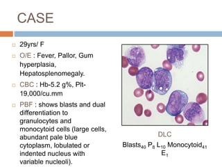 CASE
 29yrs/ F
 O/E : Fever, Pallor, Gum
hyperplasia,
Hepatosplenomegaly.
 CBC : Hb-5.2 g%, Plt-
19,000/cu.mm
 PBF : shows blasts and dual
differentiation to
granulocytes and
monocytoid cells (large cells,
abundant pale blue
cytoplasm, lobulated or
indented nucleus with
variable nucleoli).
DLC
Blasts40 P8 L10 Monocytoid41
E1
 