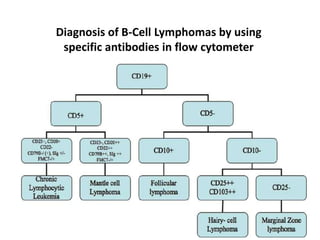 Diagnosis of B-Cell Lymphomas by using
specific antibodies in flow cytometer
 
