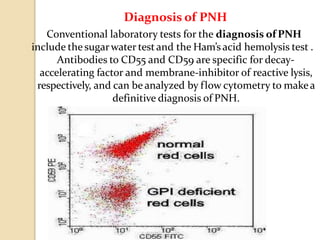 Diagnosis of PNH
Conventional laboratory tests for the diagnosis of PNH
include the sugarwater testand the Ham’s acid hemolysis test .
Antibodies to CD55 and CD59 are specific for decay-
accelerating factor and membrane-inhibitor of reactive lysis,
respectively, and can be analyzed by flow cytometry to makea
definitive diagnosis of PNH.
 