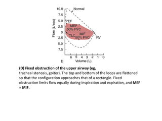Kyphoscoliosis Flow Volume Loop