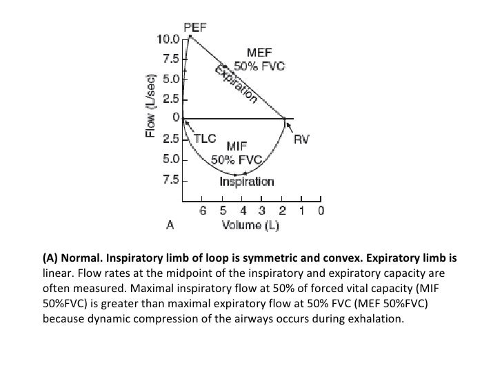 flow volume loop flow volume loop
