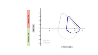 Flow Volume Loop Presentation.pptx
