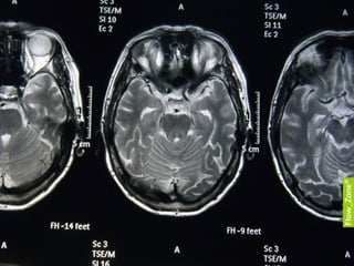 Flow Zone Learntec Pecha Kucha Lecture slideshare 12 02