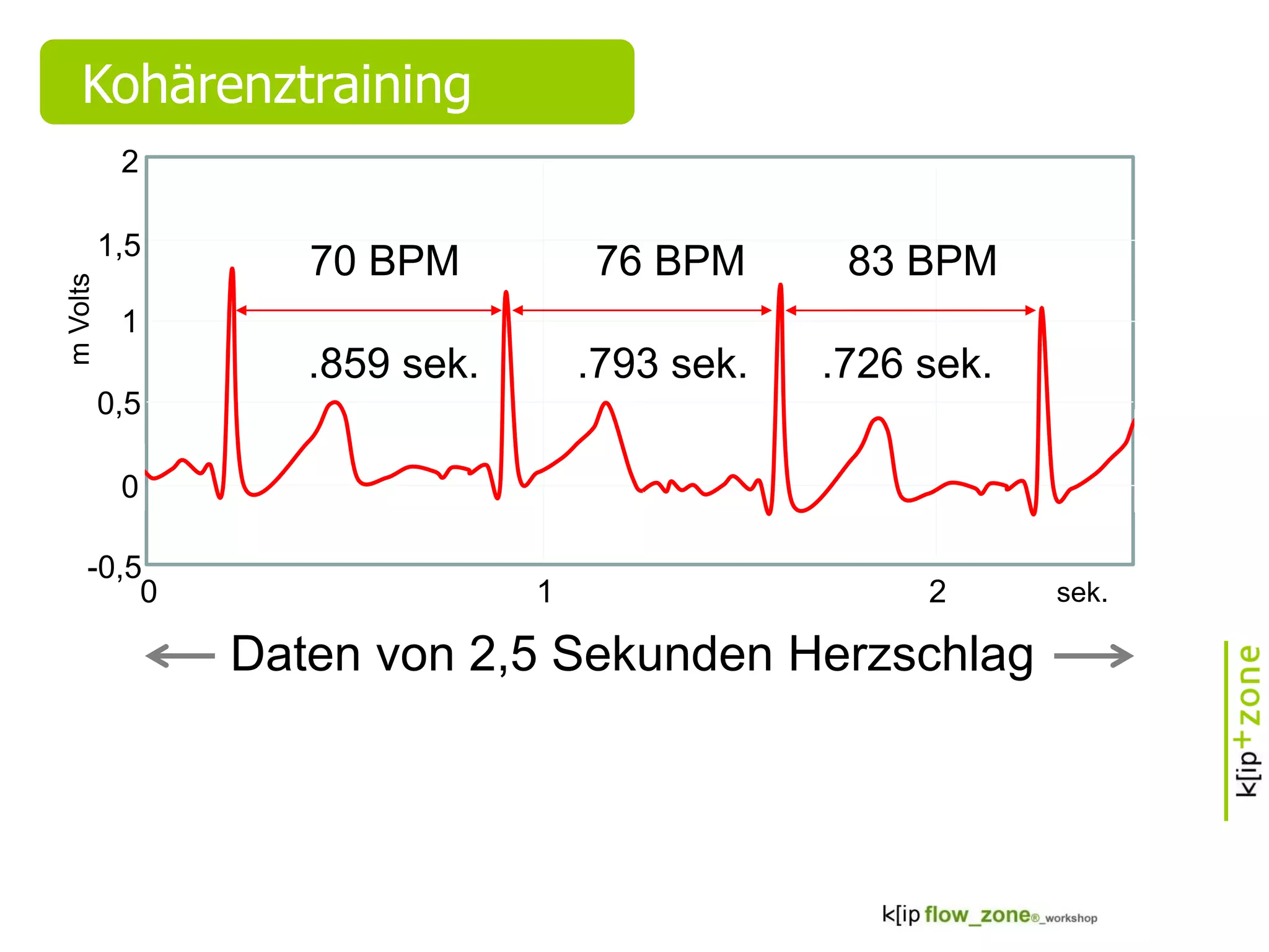 Kohärenztraining
70 BPM 76 BPM
.859 sek. .793 sek.
mVolts
-0,5
0,5
1,5
1
2
Daten von 2,5 Sekunden Herzschlag
210
0
sek.
83 BPM
.726 sek.
 