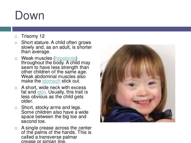 Different Kinds of syndrome