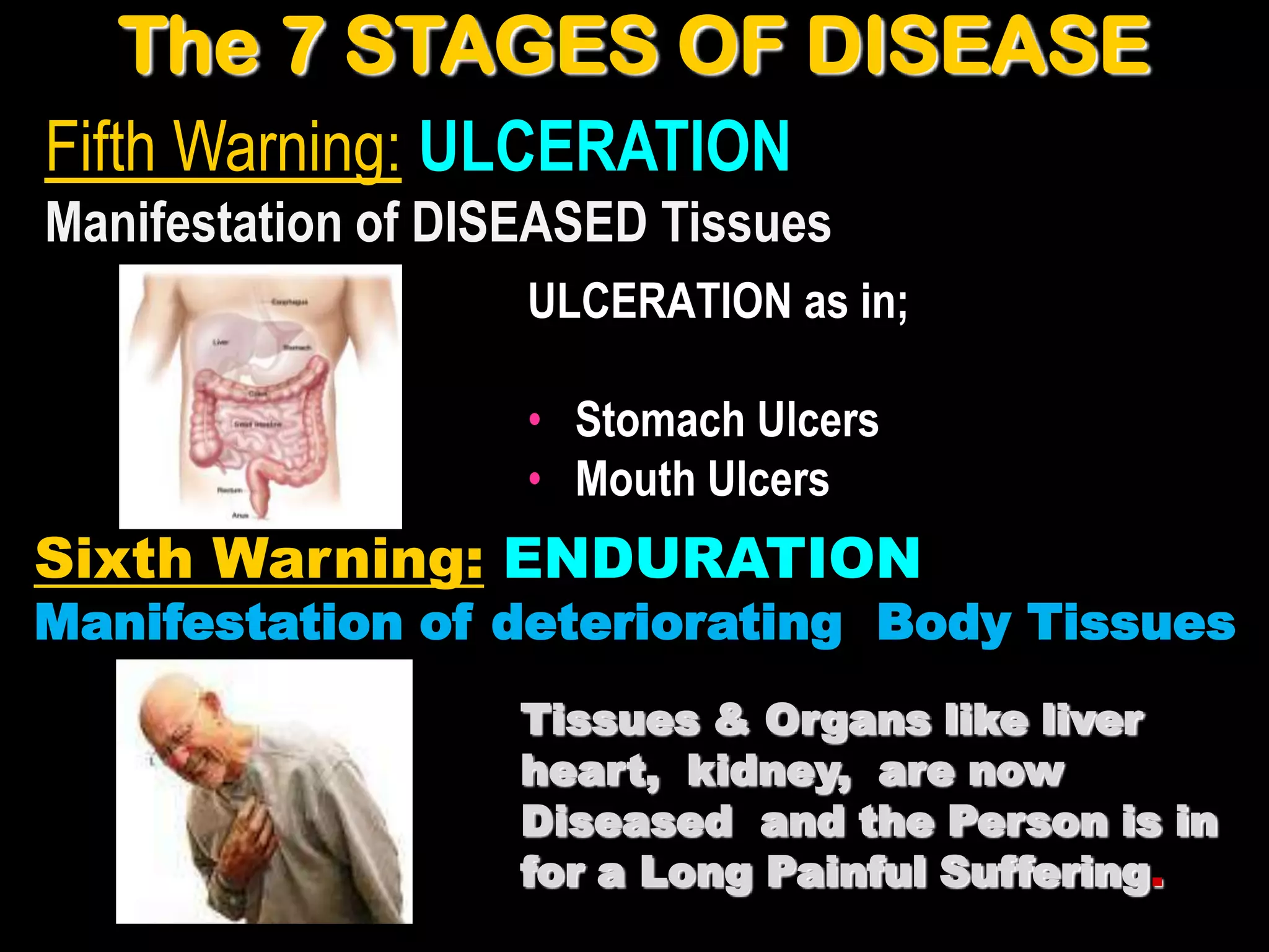 The 7 STAGES OF DISEASE
Fifth Warning: ULCERATION
Manifestation of DISEASED Tissues
                    ULCERATION as in;

                    • Stomach Ulcers
                    • Mouth Ulcers
Sixth Warning: ENDURATION
Manifestation of deteriorating Body Tissues
                   Tissues & Organs like liver
                   heart, kidney, are now
                   Diseased and the Person is in
                   for a Long Painful Suffering.
 