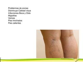 Forever Living Products
Ecatepec,Mexico
Problermas de encias
Disminuye Calidad visua
Infecciones Boca y Oido
Migrañas
Varices
Pies hinchados
Pies calientes
 