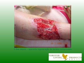 3 dias depois – aparente regeneração de tecidos comprovada. 