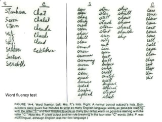 Word fluency test
 