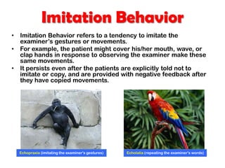 Imitation Behavior
• Imitation Behavior refers to a tendency to imitate the
examiner’s gestures or movements.
• For example, the patient might cover his/her mouth, wave, or
clap hands in response to observing the examiner make these
same movements.
• It persists even after the patients are explicitly told not to
imitate or copy, and are provided with negative feedback after
they have copied movements.
Echopraxia (imitating the examiner's gestures) Echolalia (repeating the examiner's words)
 