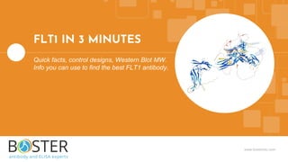 www.bosterbio.com
FLT1 IN 3 MINUTES
Quick facts, control designs, Western Blot MW.
Info you can use to find the best FLT1 antibody.
 