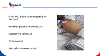 Severe Influenza pneumonia in children .pptx