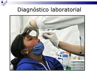 Diagnóstico laboratorial 