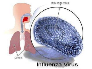 Flu H1 N1