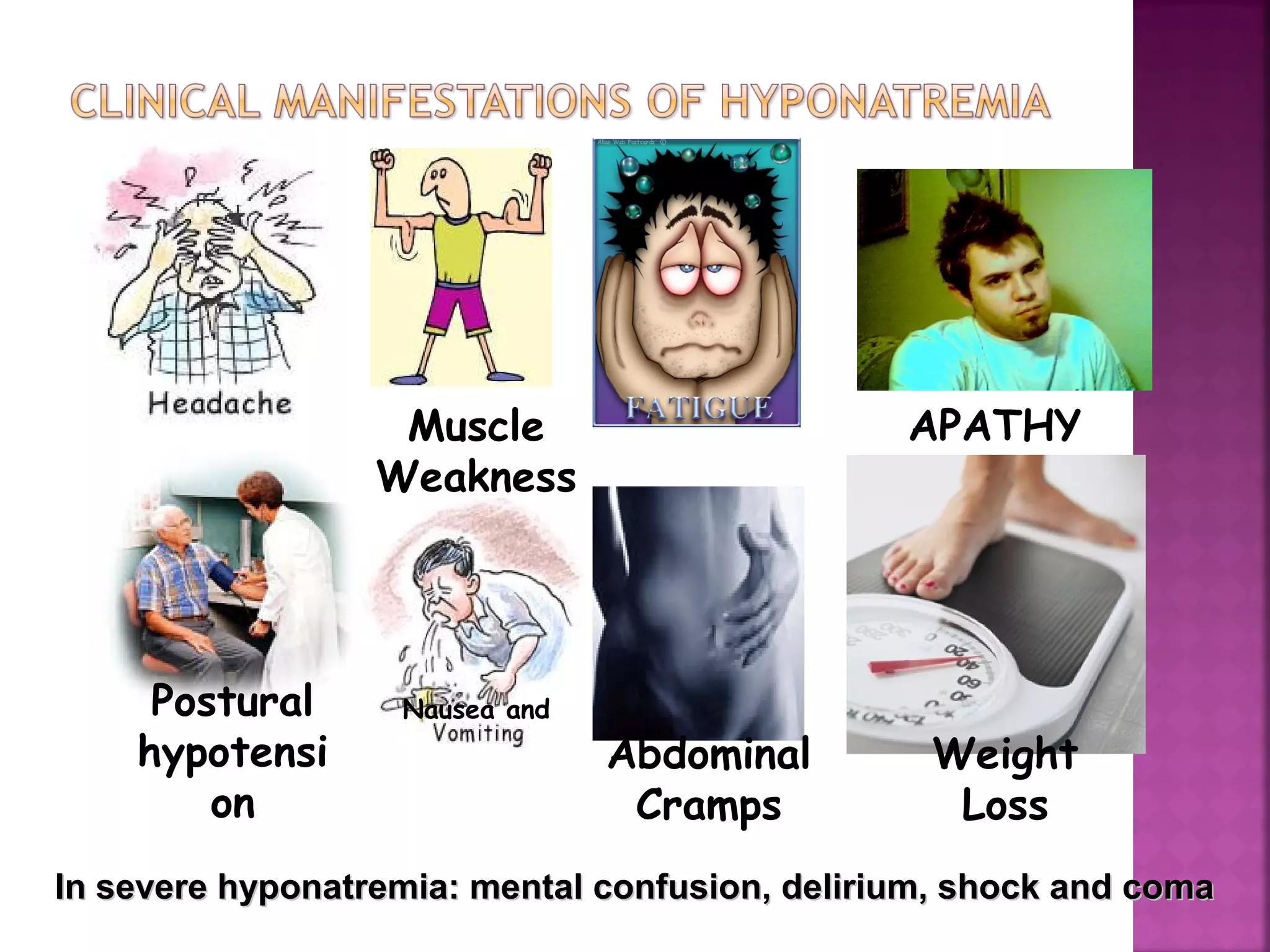fluid and electrolyte imbalance | PPT