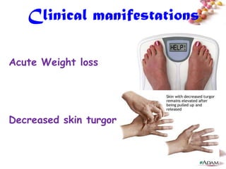 Clinical manifestations

Acute Weight loss




Decreased skin turgor


                             #
 