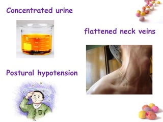 Concentrated urine

                       flattened neck veins




Postural hypotension




                                        #
 