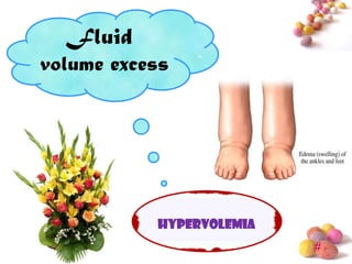Fluid
volume excess




           hypervolemia
                          #
 