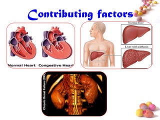 Contributing factors




                       #
 