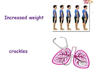 Increased weight




 crackles

                   #
 