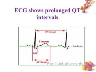 ECG shows prolonged QT
       intervals




                         #
 