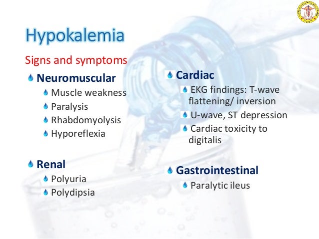 Diabetes Insipidus Fluid Balance Diabetes Insipidus Fluid Balance
