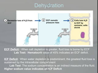 Dehydration
Excessive loss of H2O from
ECF
1 2 3ECF osmotic
pressure rises
Cells lose H2O
to ECF by
osmosis; cells
shrink
ECF Deficit : When salt depletion is greater, fluid loss is borne by ECF
Lab Test: Hematocrit value of 45% indicates an ECF deficit.
ICF Deficit : When water depletion is predominant, the greatest fluid loss is
sustained by the intracellular compartment
Lab Test :The sodium concentration is an indirect measure of the fluid.
Higher sodium value indicates an ICF Deficit
 