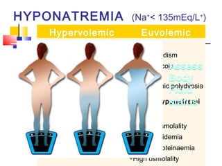 HYPONATREMIA                      (Na+< 135mEq/L+)
      Hypervolemic    Euvolemic
            Hypovolemic
  •CHF
  Extra renal loss
                                •SIADH
                        Renal loss
                                •Hypothyroidism
  (urine Na+
  •Nephrotic syndrome   (urine Na+ >15mEq/L)
  <15mEq/L )                    •Glucocorticoid
                        •Excessive diuretics
  •Cirrhosis
                                deficiency
                        •Salt losing
  TURP syndrome
  Vomiting
  •                             •Psychogenic polydypsia

  Diarrhoea
  •
  Renal Failure
  •                                  nephropathy
                              •Pseudohyponatremi
  ( urine Na+ >20mEq/L) •Diabetic ketoacidosis
  •Peritonitis                a
                        •Cerebral salt wasting
                              Normal osmolality
  •Tube drainage


  Fistula
  •                     syndromehyperlipidemia
  obstruction
  •                             hyperproteinaemia
  Burn wound
  •                              High osmolality
 