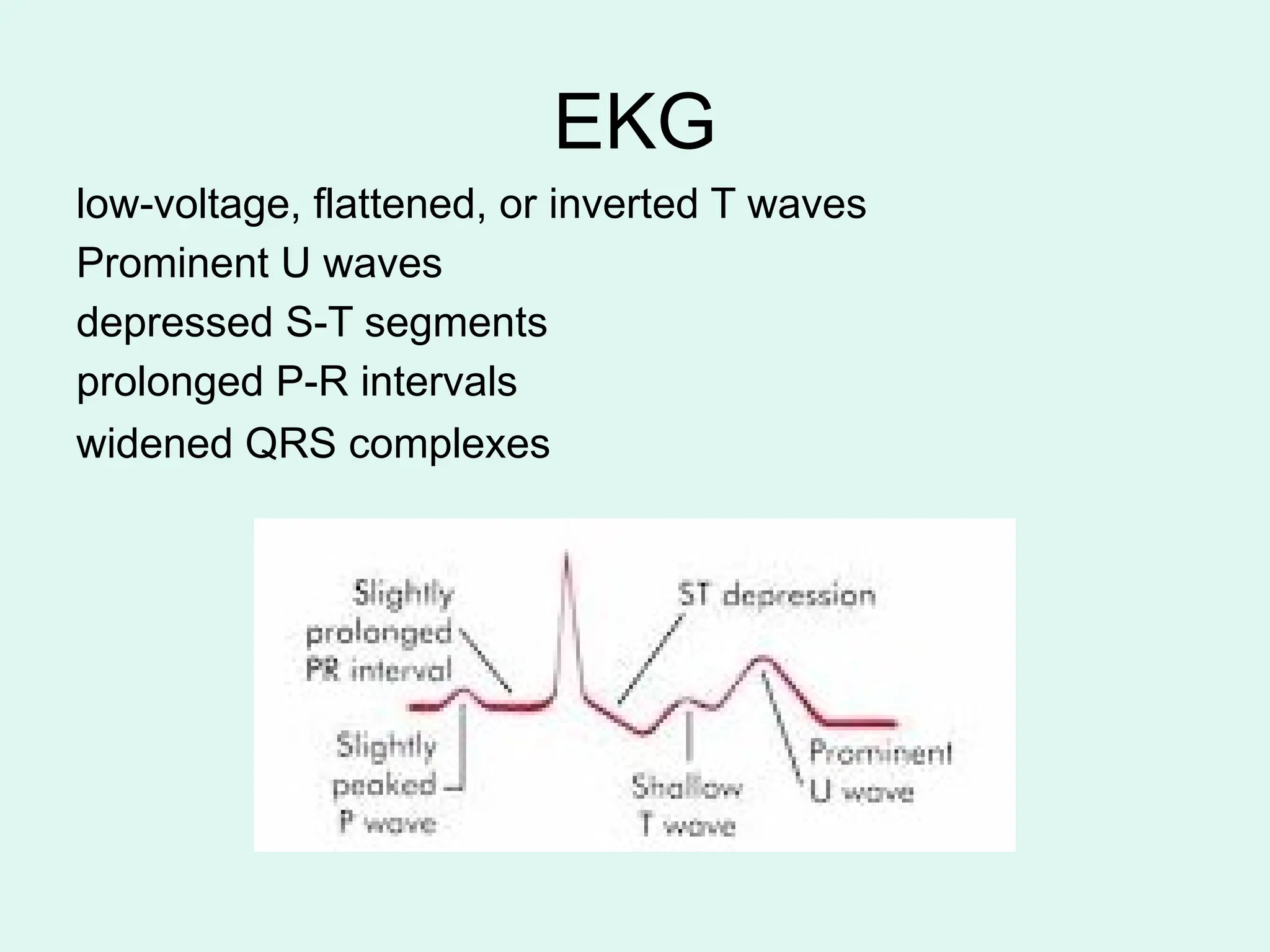 EKG
low-voltage, flattened, or inverted T waves
Prominent U waves
depressed S-T segments
prolonged P-R intervals
widened QRS complexes
 