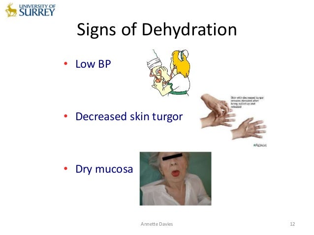 fluid assessment skin turgor charting