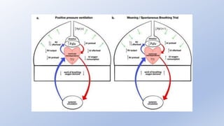 Fluid Balance and Weaning From Mechanical Ventilation.pptx