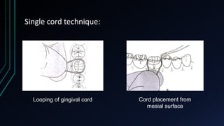 Fluid control and ginigival retraction | PPTX