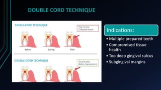 DOUBLE CORD TECHNIQUE
Indications:
• Multiple prepared teeth
• Compromised tissue
health
• Too deep gingival sulcus
• Subg...