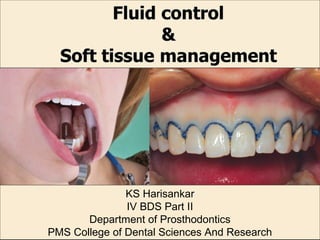 KS Harisankar
IV BDS Part II
Department of Prosthodontics
PMS College of Dental Sciences And Research
 
