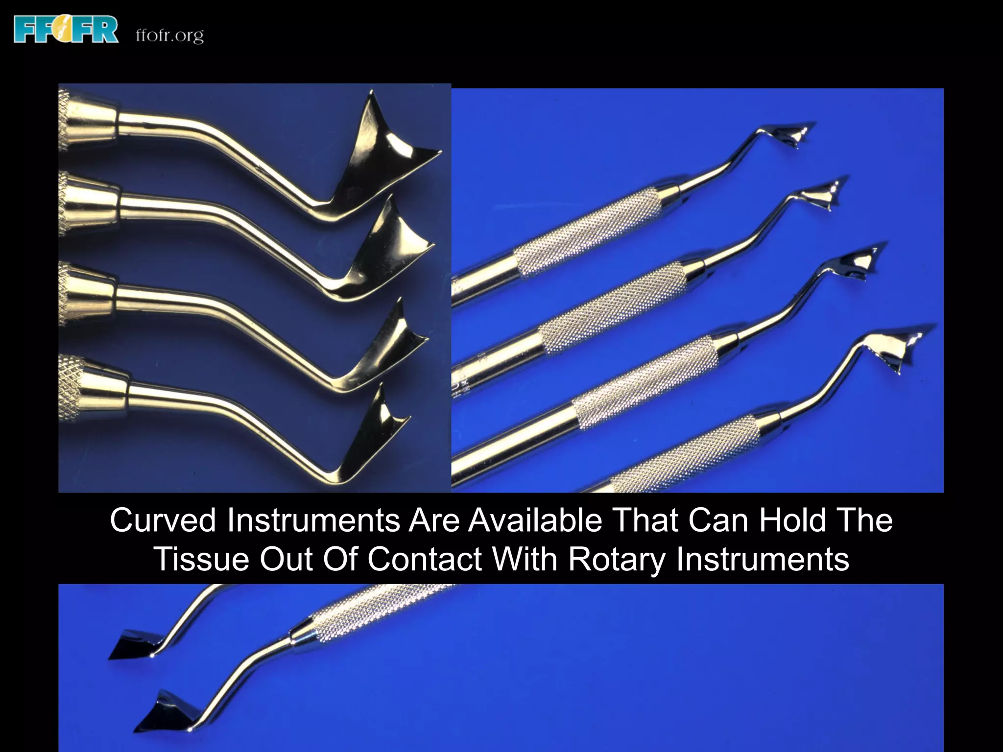 Curved Instruments Are Available That Can Hold The
Tissue Out Of Contact With Rotary Instruments
 