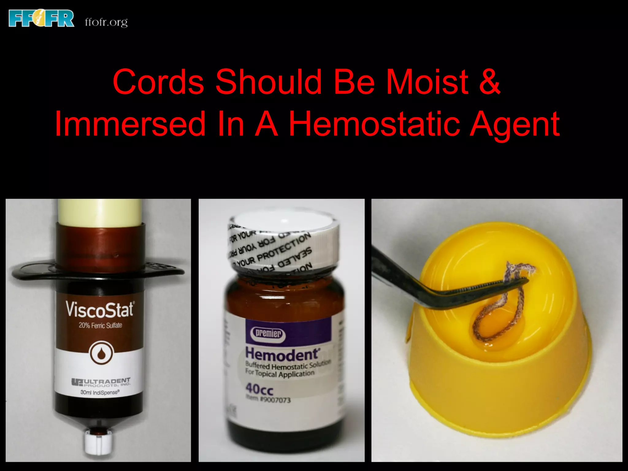 Cords Should Be Moist &
Immersed In A Hemostatic Agent
 