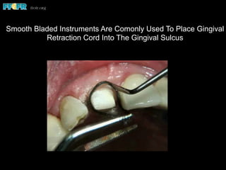 Fluid control and tissue managemtent | PDF