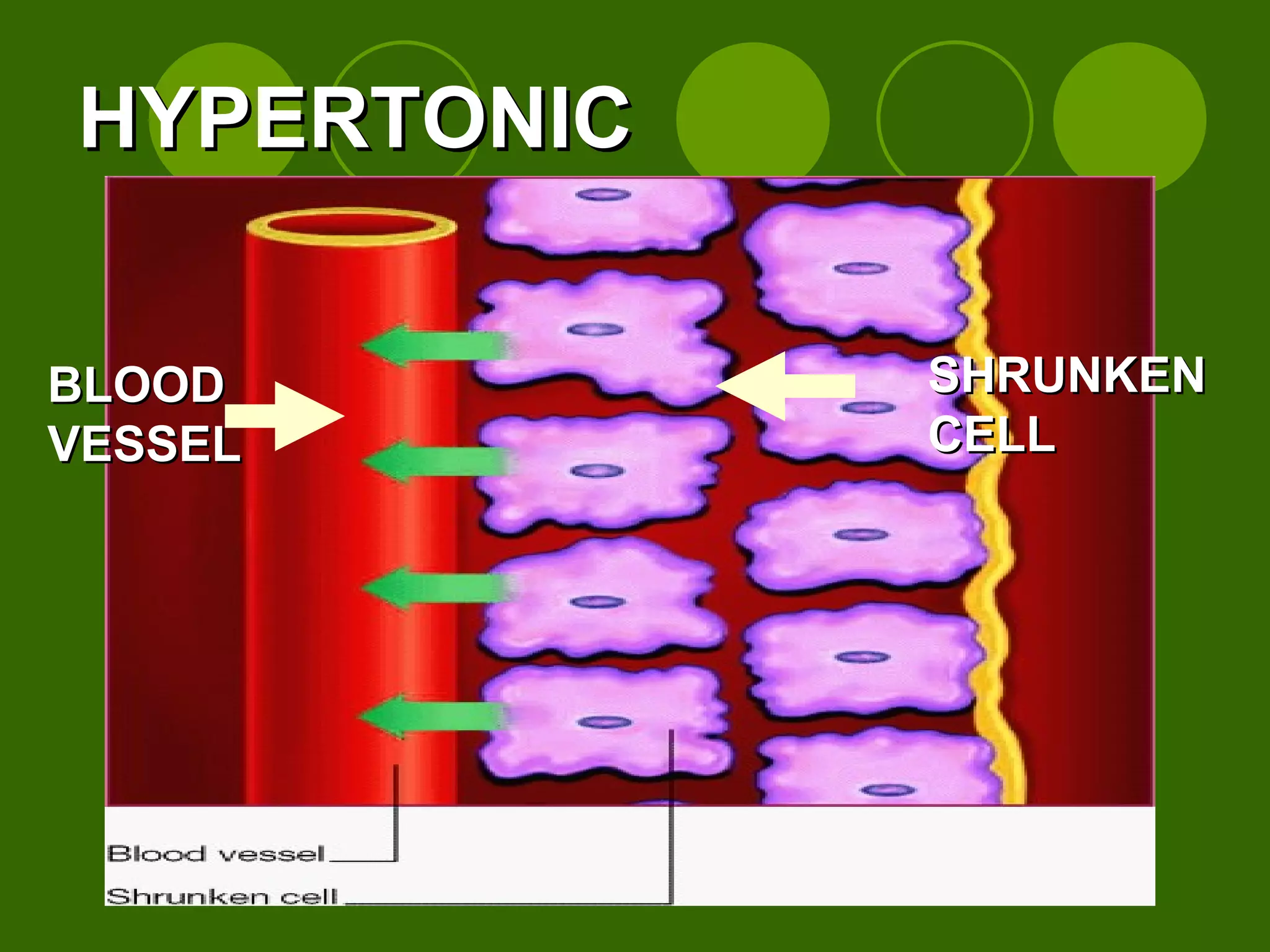 BLOOD VESSEL SHRUNKEN CELL HYPERTONIC 