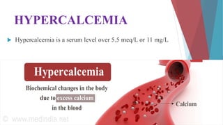 HYPERCALCEMIA
 Hypercalcemia is a serum level over 5.5 meq/L or 11 mg/L
 