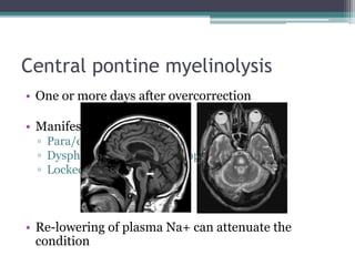 Central pontine myelinolysis
• One or more days after overcorrection
• Manifestations:
▫ Para/quadriparasis
▫ Dysphagia/dysarthria/diplopia
▫ Locked in syndrome
• Re-lowering of plasma Na+ can attenuate the
condition
 