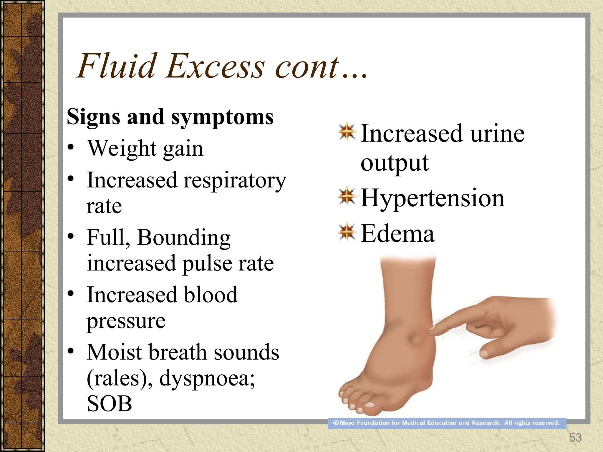 Fluid Excess cont…
Signs and symptoms
• Weight gain
• Increased respiratory
rate
• Full, Bounding
increased pulse rate
• Increased blood
pressure
• Moist breath sounds
(rales), dyspnoea;
SOB
Increased urine
output
Hypertension
Edema
53
 