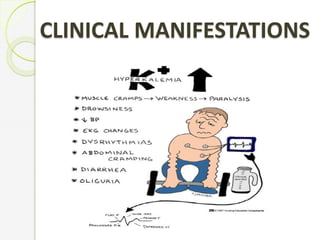 CLINICAL MANIFESTATIONS
 