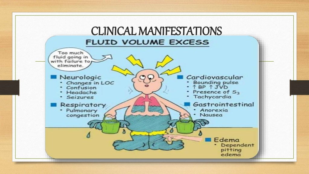 A Classification Of Fluid Imbalance Download Scientif vrogue.co