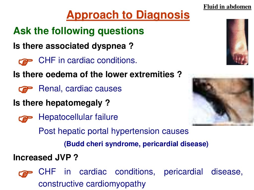 Fluid in abdomen