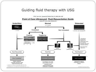 Guiding fluid therapy with USG
 