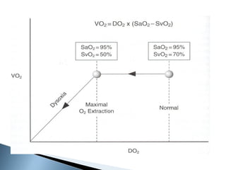 Fluid manage 최종[1] | PPT