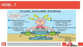 Fluid management & anesthesia | PDF